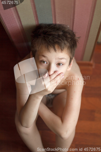 Image of Boy with chickenpox