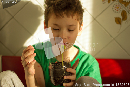 Image of Boy with chickenpox grow plant