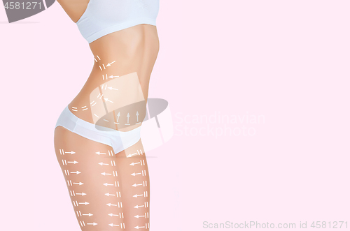 Image of The cellulite removal plan. White markings on young woman body 