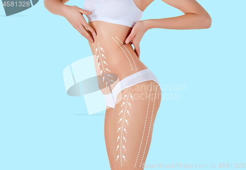 Image of The cellulite removal plan. White markings on young woman body