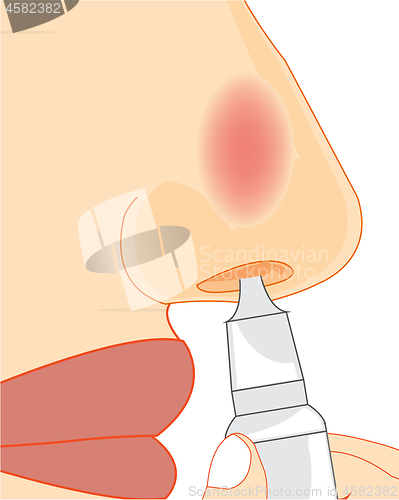Image of Vector illustration of the sick nose and medicine