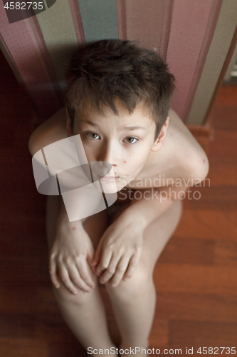 Image of Boy with chickenpox