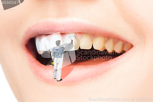 Image of woman teeth before and after whitening. Over white background