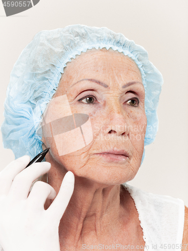 Image of surgeon doing skin check on mid age woman before plastic surgery