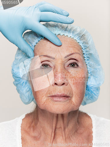 Image of surgeon doing skin check on mid age woman before plastic surgery