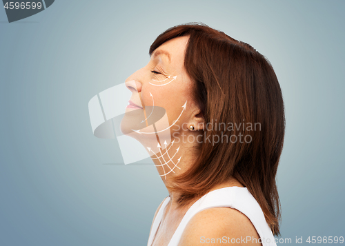 Image of profile of senior woman with face lifting arrows