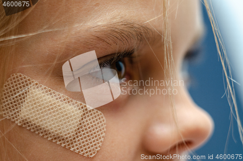 Image of A medical band-aid is glued under the girl\'s eye