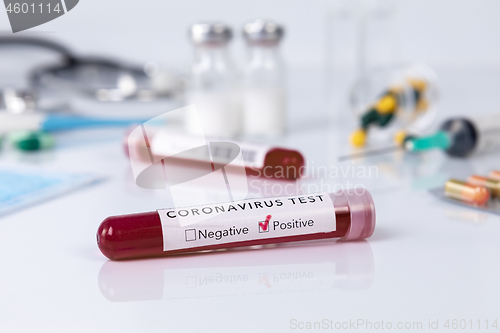 Image of Blood test tube with the Coronavirus disease for virus test and 