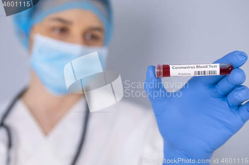 Image of Nurse holding test tube with Positive Coronavirus test blood sam