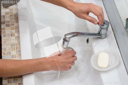 Image of A man washes a wound on his hand under a stream of water in the washbasin