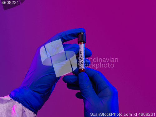 Image of Coronavirus, Doctor holding positive covid-19 virus Blood Sample