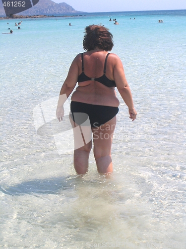 Image of Obese woman