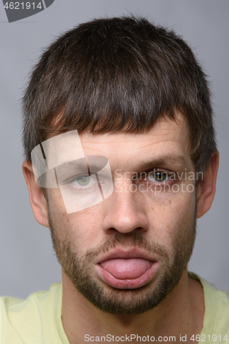 Image of Portrait of a sad man of European appearance who is sick, close-up