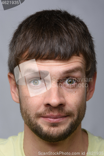 Image of Close-up portrait of a man with bulging eyes of European appearance