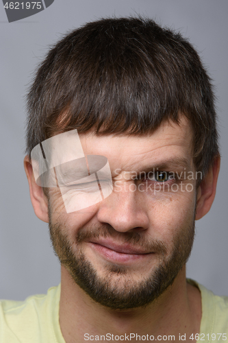 Image of Close-up portrait of a man covering one eye, European appearance