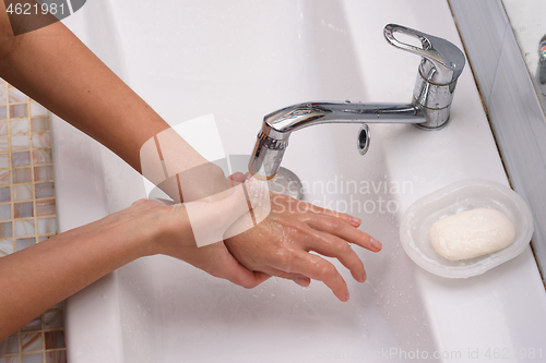 Image of The girl brought the burn place under a stream of water for first aid