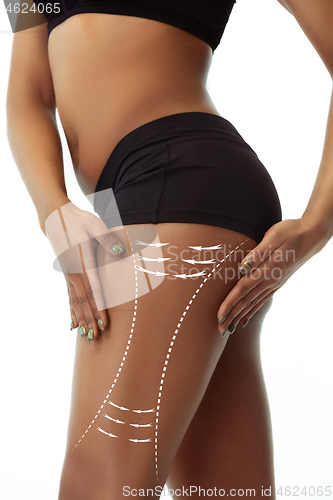 Image of Beautiful female legs and hips on white background. Beauty, cosmetics, spa, bodycare and lifting, correction surgery, fitness concept