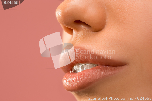 Image of Beautiful young woman with teeth braces