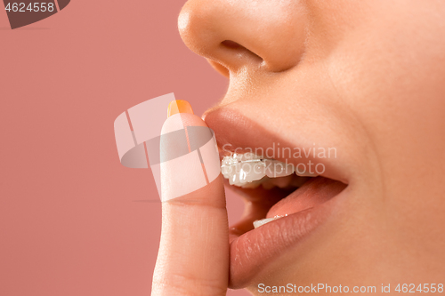 Image of Beautiful young woman with teeth braces