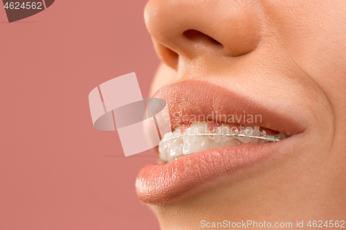 Image of Beautiful young woman with teeth braces