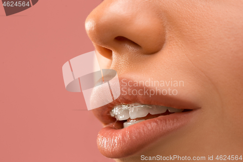 Image of Beautiful young woman with teeth braces