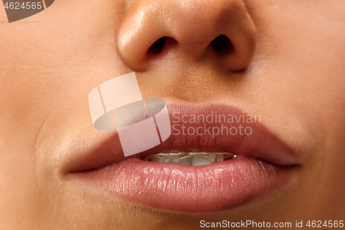 Image of Beautiful young woman with teeth braces