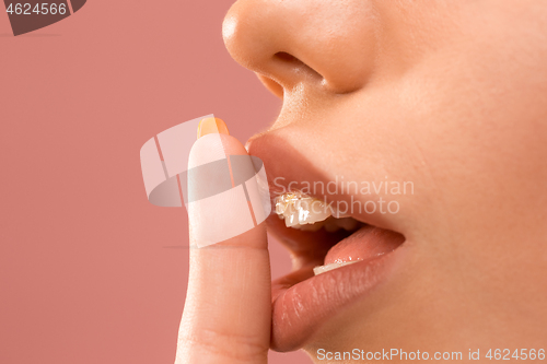 Image of Beautiful young woman with teeth braces