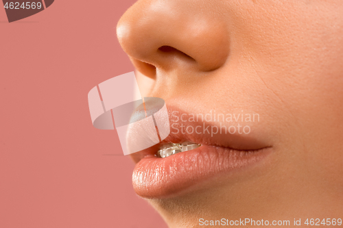 Image of Beautiful young woman with teeth braces