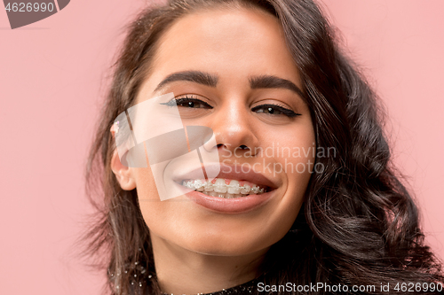 Image of Beautiful young woman with teeth braces