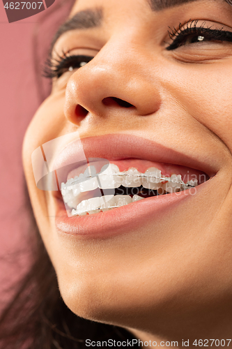 Image of Beautiful young woman with teeth braces