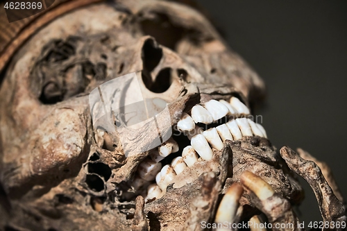 Image of Skulls of a mummy