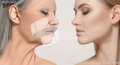 Image of Comparison. Portrait of beautiful woman with problem and clean skin, aging and youth concept, beauty treatment