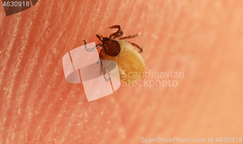Image of Tick on skin