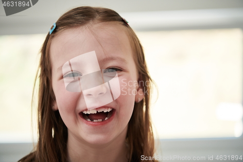 Image of little girl without tooth smiling