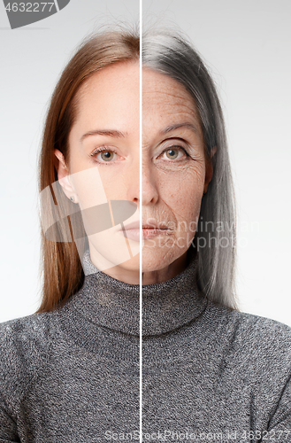 Image of Comparison. Portrait of beautiful woman with problem and clean s