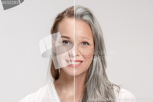 Image of Comparison. Portrait of beautiful woman with problem and clean skin, aging and youth concept, beauty treatment