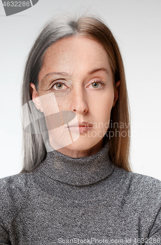 Image of Comparison. Portrait of beautiful woman with problem and clean s