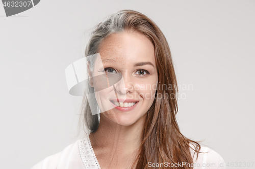 Image of Comparison. Portrait of beautiful woman with problem and clean skin, aging and youth concept, beauty treatment