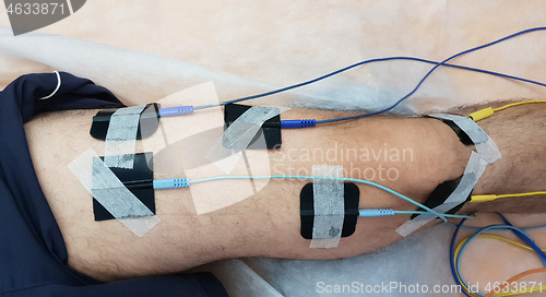 Image of Electrostimulation of the quadriceps as a physiotherapy therapy 