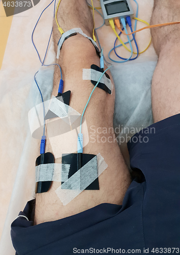 Image of Electrostimulation of the quadriceps as a physiotherapy therapy 