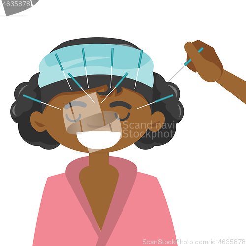 Image of African-american woman getting acupuncture therapy
