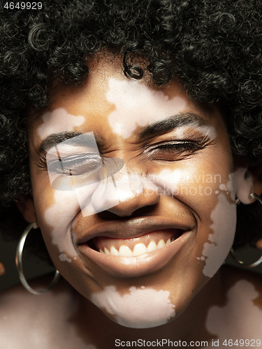 Image of Studio portrait of african-american woman with vitiligo skin, beauty concept