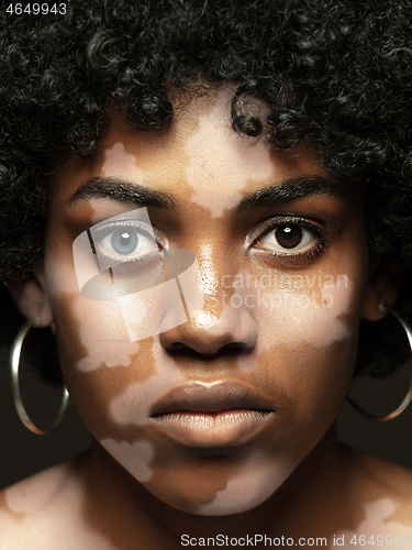 Image of Studio portrait of african-american woman with vitiligo skin, beauty concept