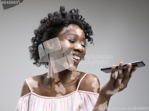 Image of Studio portrait of african-american woman with vitiligo skin, beauty concept
