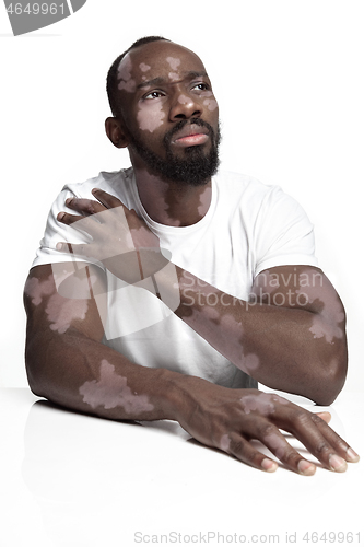 Image of Studio portrait of african-american man with vitiligo skin, beauty concept
