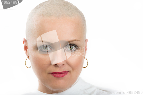 Image of beautiful middle age woman cancer patient without hair