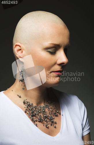 Image of beautiful middle age woman cancer patient without hair