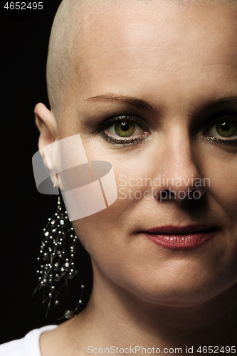 Image of beautiful middle age woman cancer patient without hair