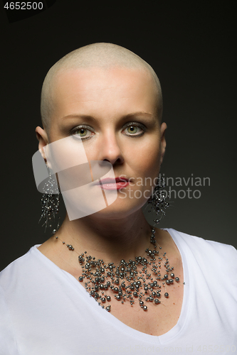 Image of beautiful middle age woman cancer patient without hair