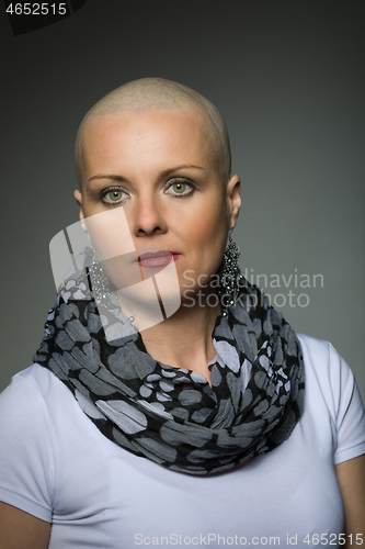 Image of beautiful middle age woman cancer patient without hair